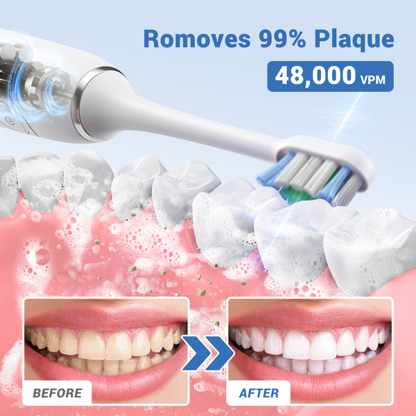 NEXPURE Sonic Electric Toothbrush for Adults, 2 Minute Smart Timer, 60 Day Long Battery Life, 4 Brush Heads & 5 Modes for Gentle Gum Care, White